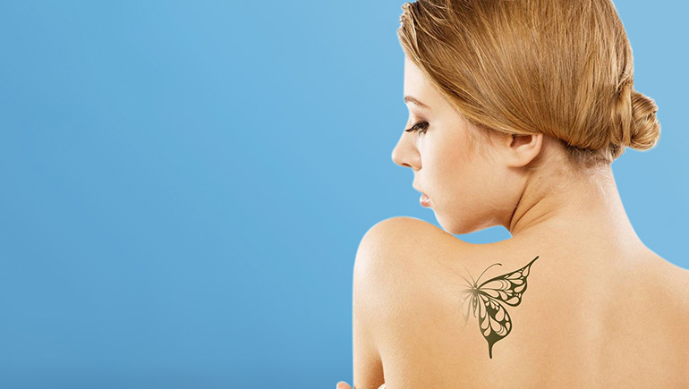 Laser Tattoo Removal Doctor in Chandigarh, Punjab | Tattoo Removal Cost in  India