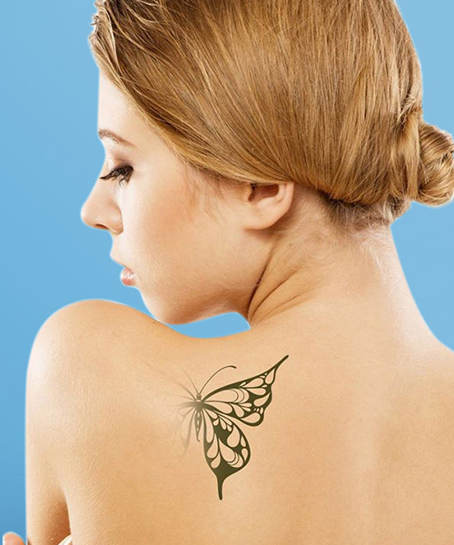 LASER TATTOO REMOVAL